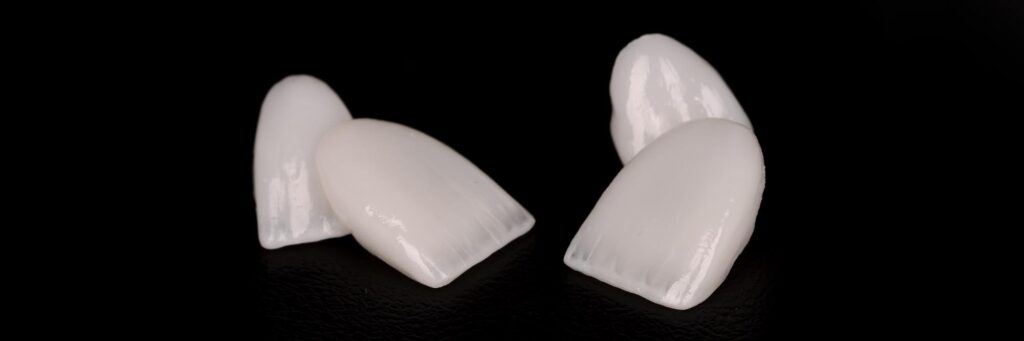 Handcrafted ceramic dental restoration
