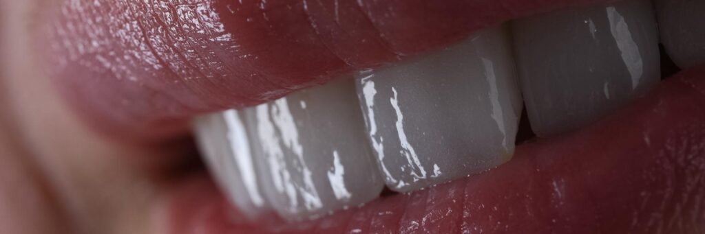 Couture smile design consultation by Dr. Nesrin Sonmez