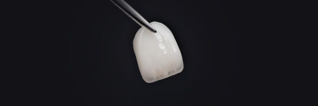Holistic dentistry approach in Istanbul