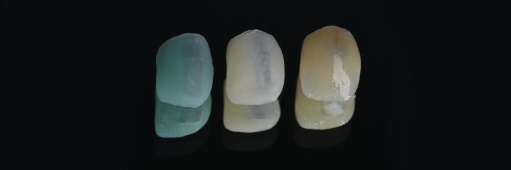 Preventive dental care and conservative treatment
