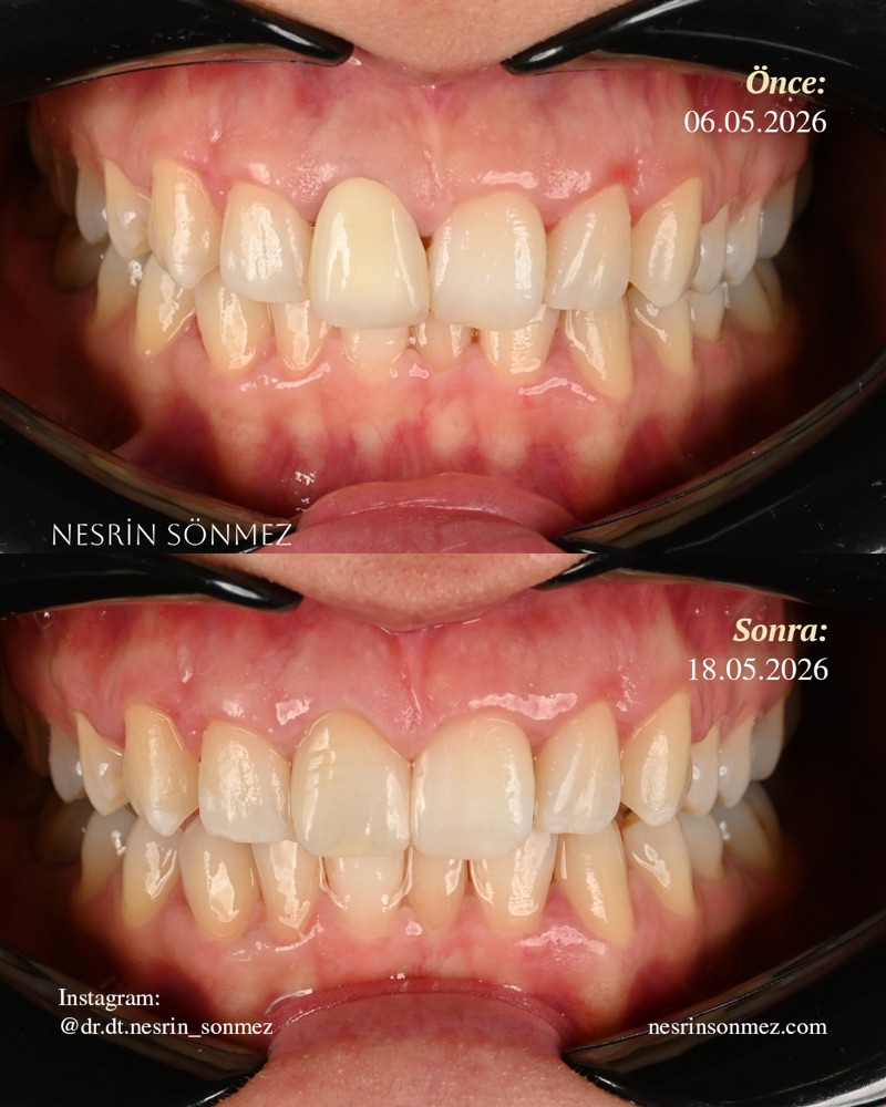 Case 2 before and after — detail view