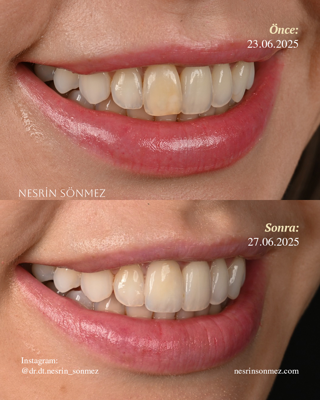 Case 3 before and after — view 2