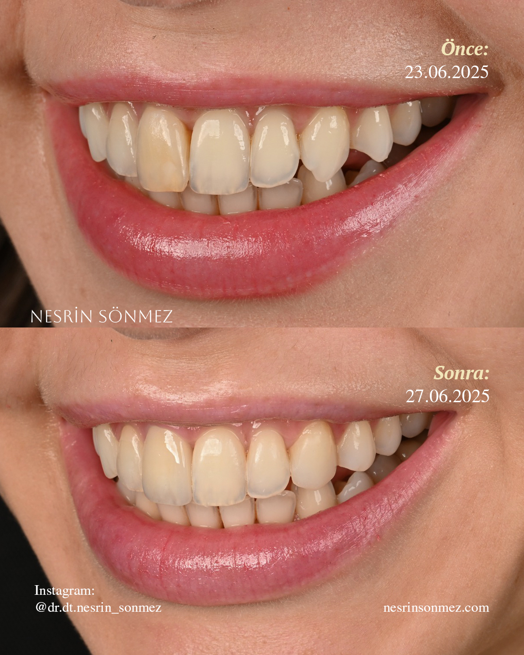Case 3 before and after — view 3