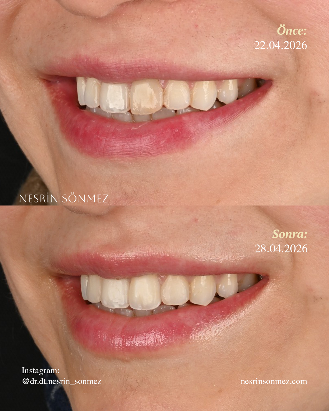 Case 4 before and after — view 2