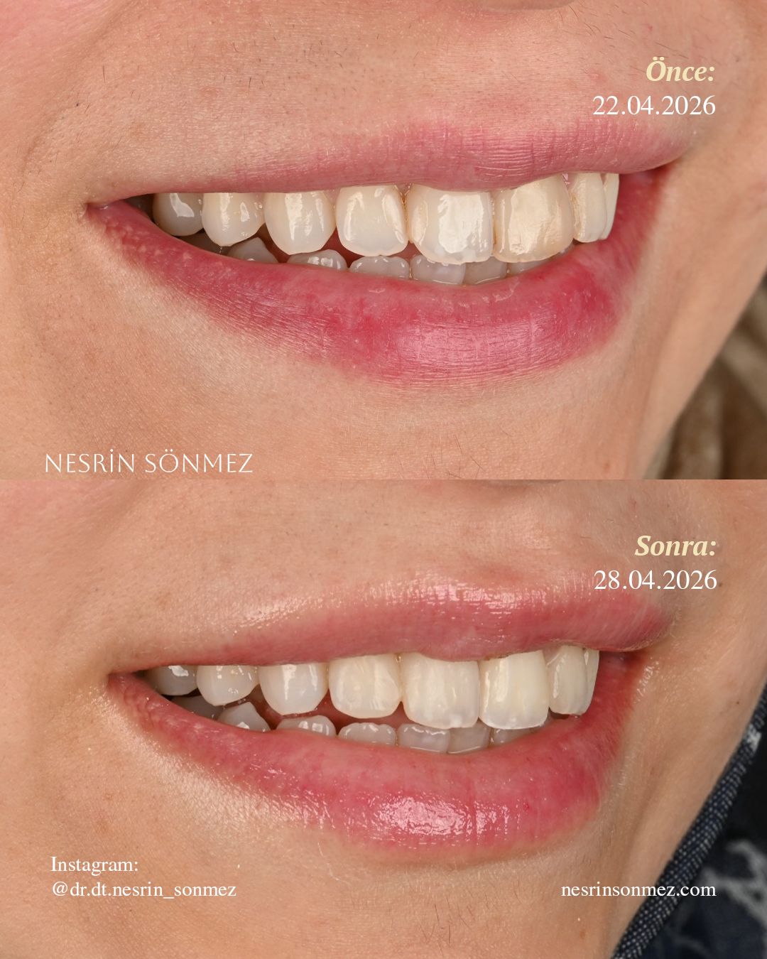 Case 4 before and after — view 3