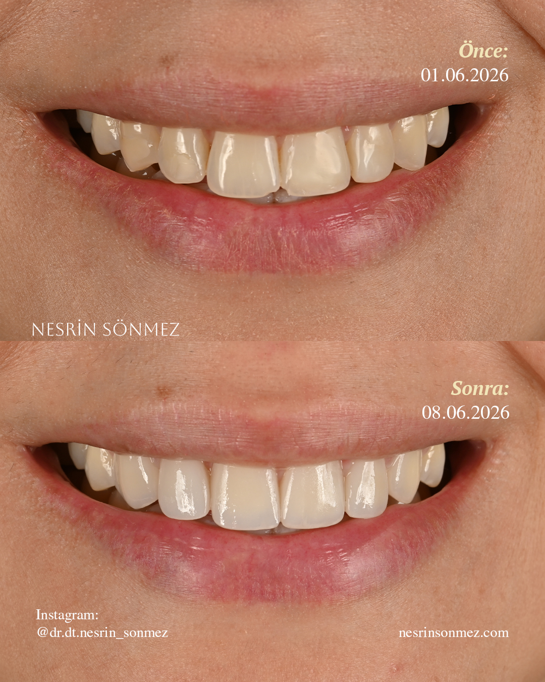 Case 5 before and after — view 1