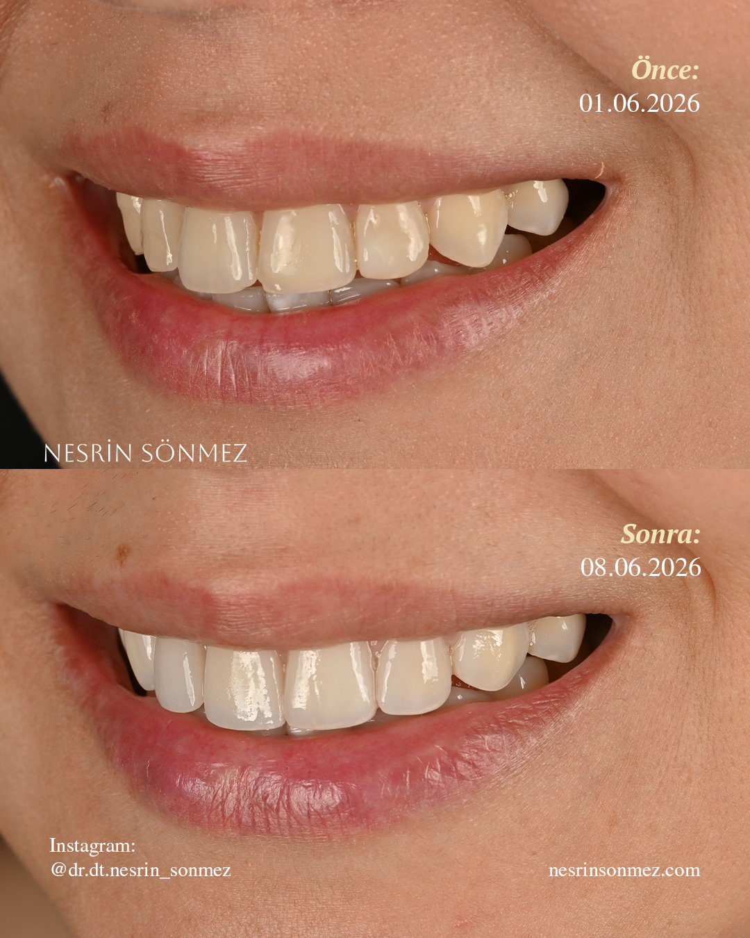 Case 5 before and after — view 2