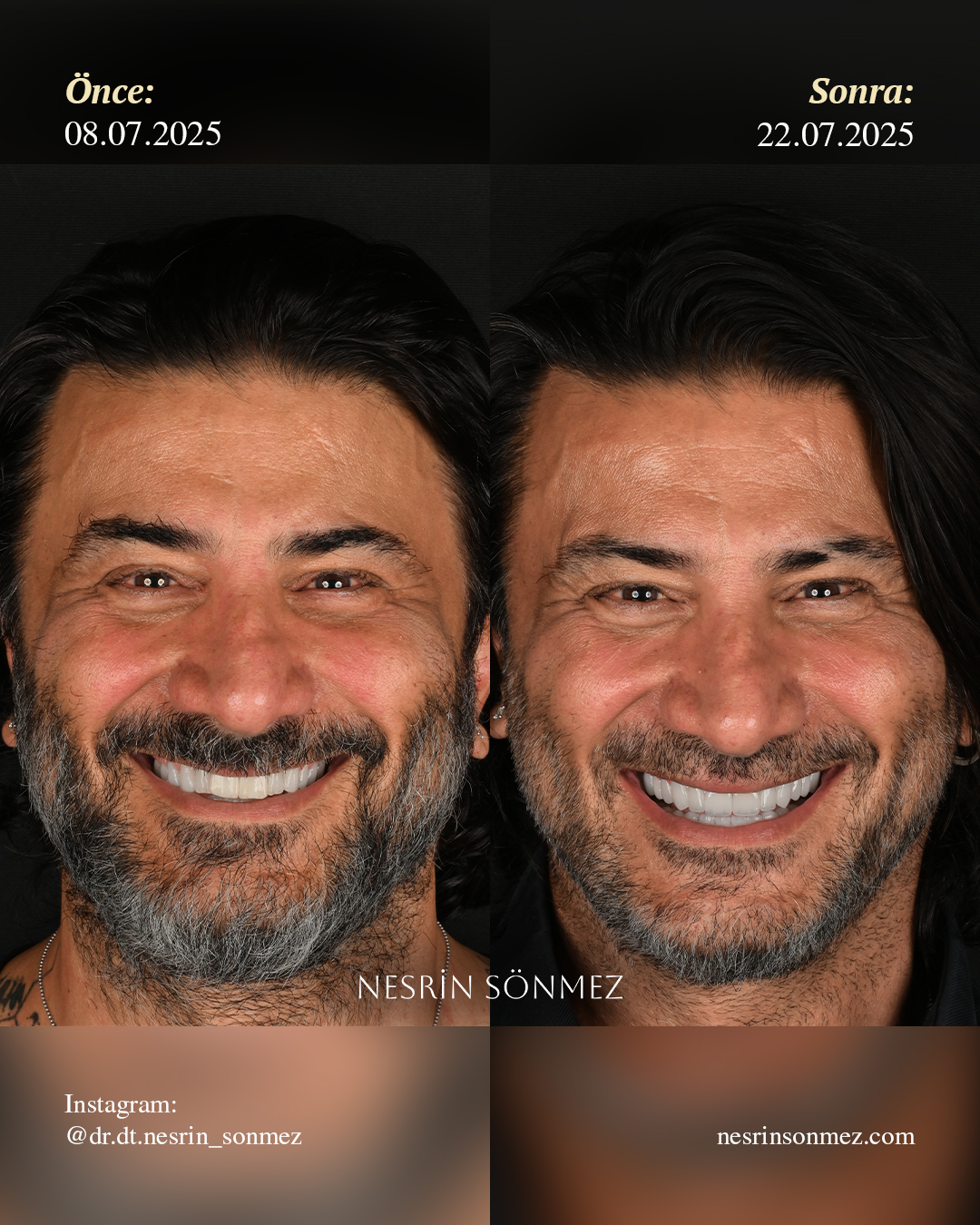 Case 7 before and after — view 1