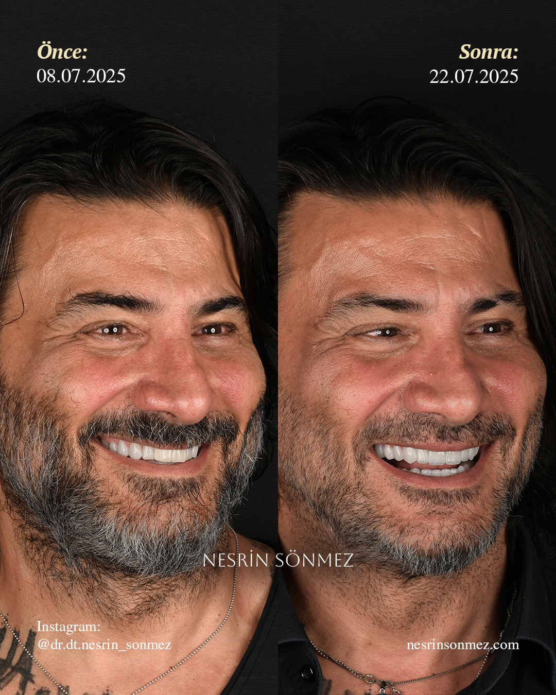 Case 7 before and after — view 2