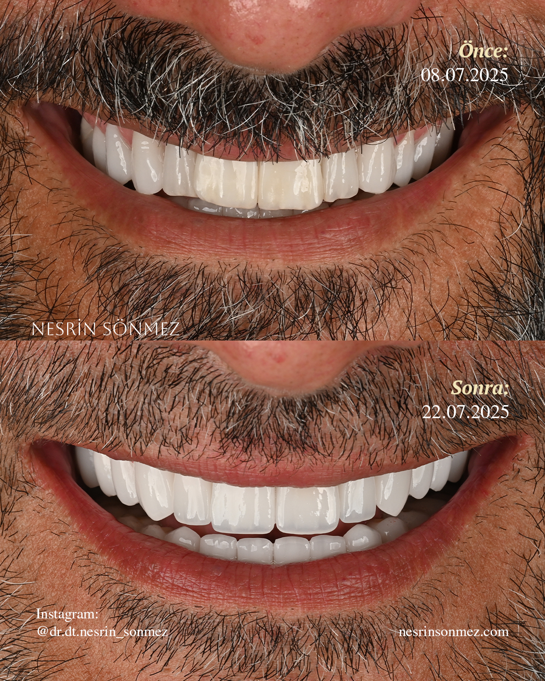 Case 7 before and after — view 3