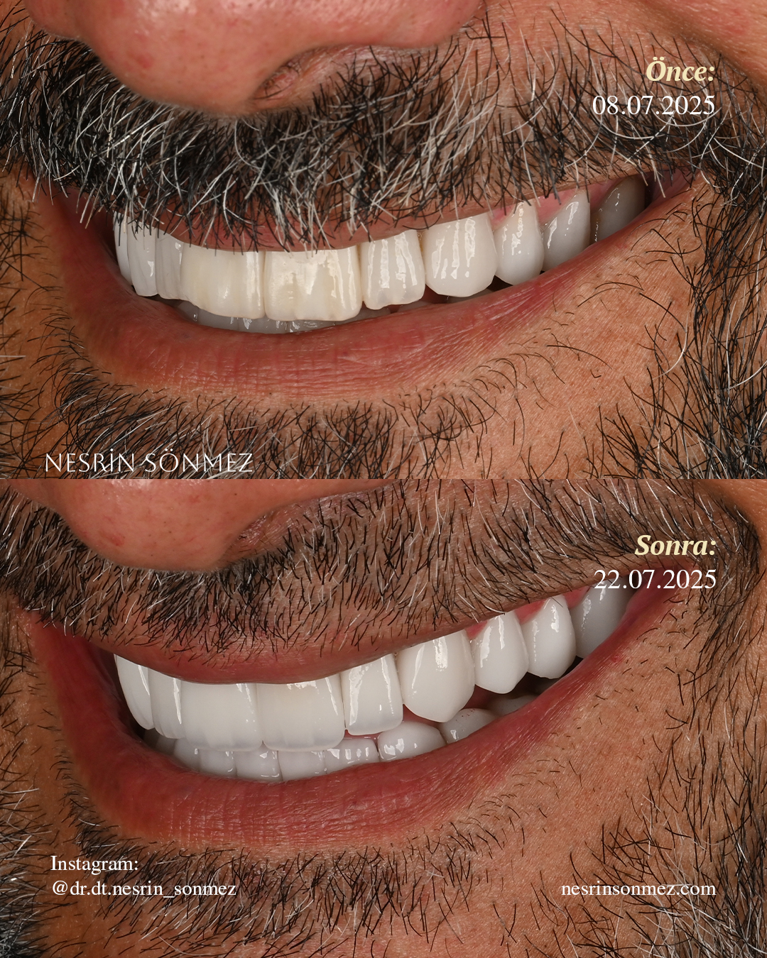 Case 7 before and after — view 4