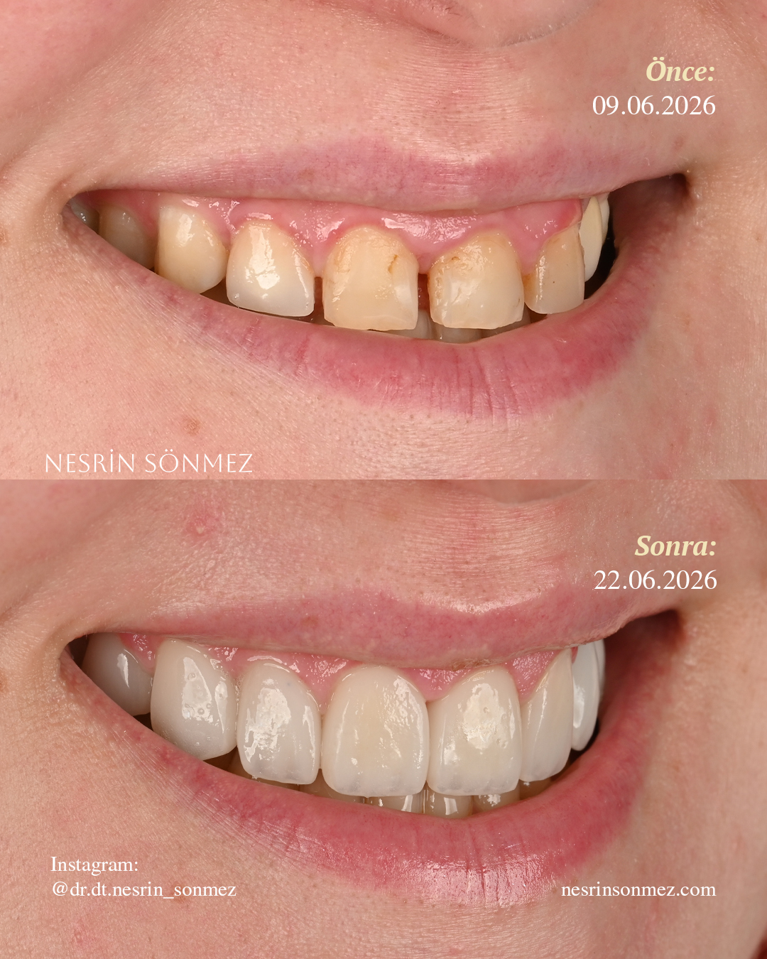 Case 8 before and after — view 2