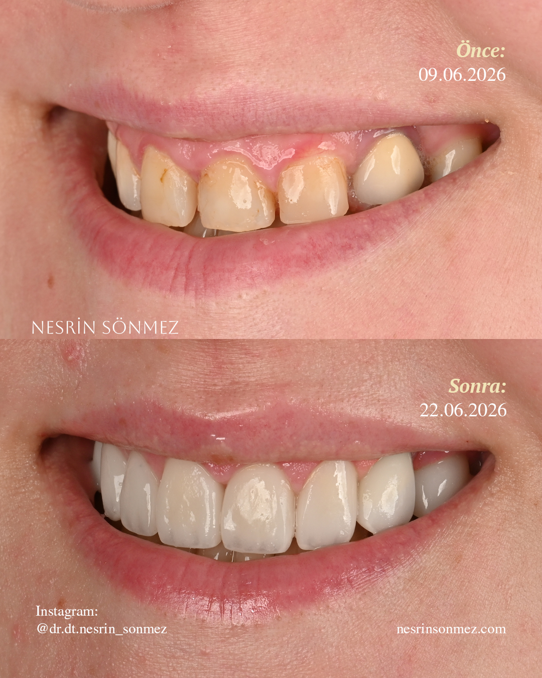 Case 8 before and after — view 3