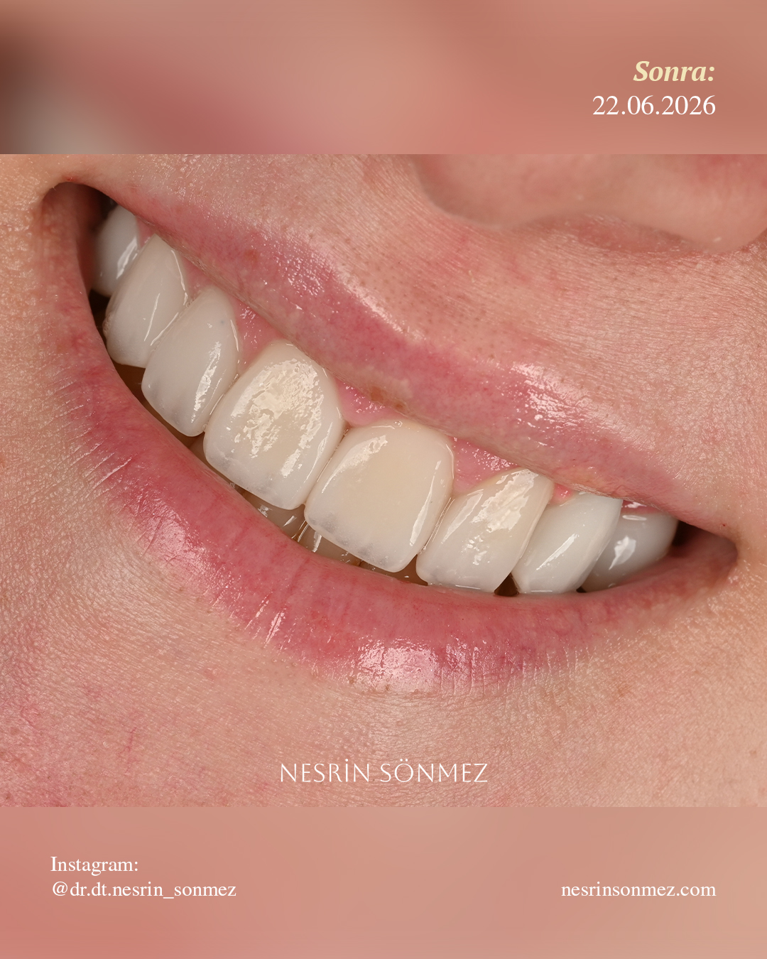 Case 8 before and after — view 4