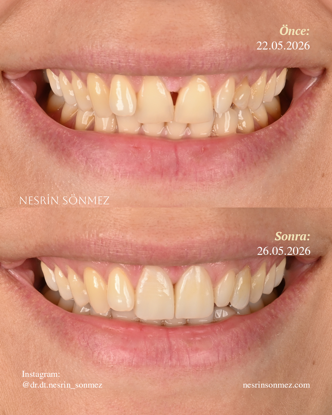 Case 9 before and after — view 1