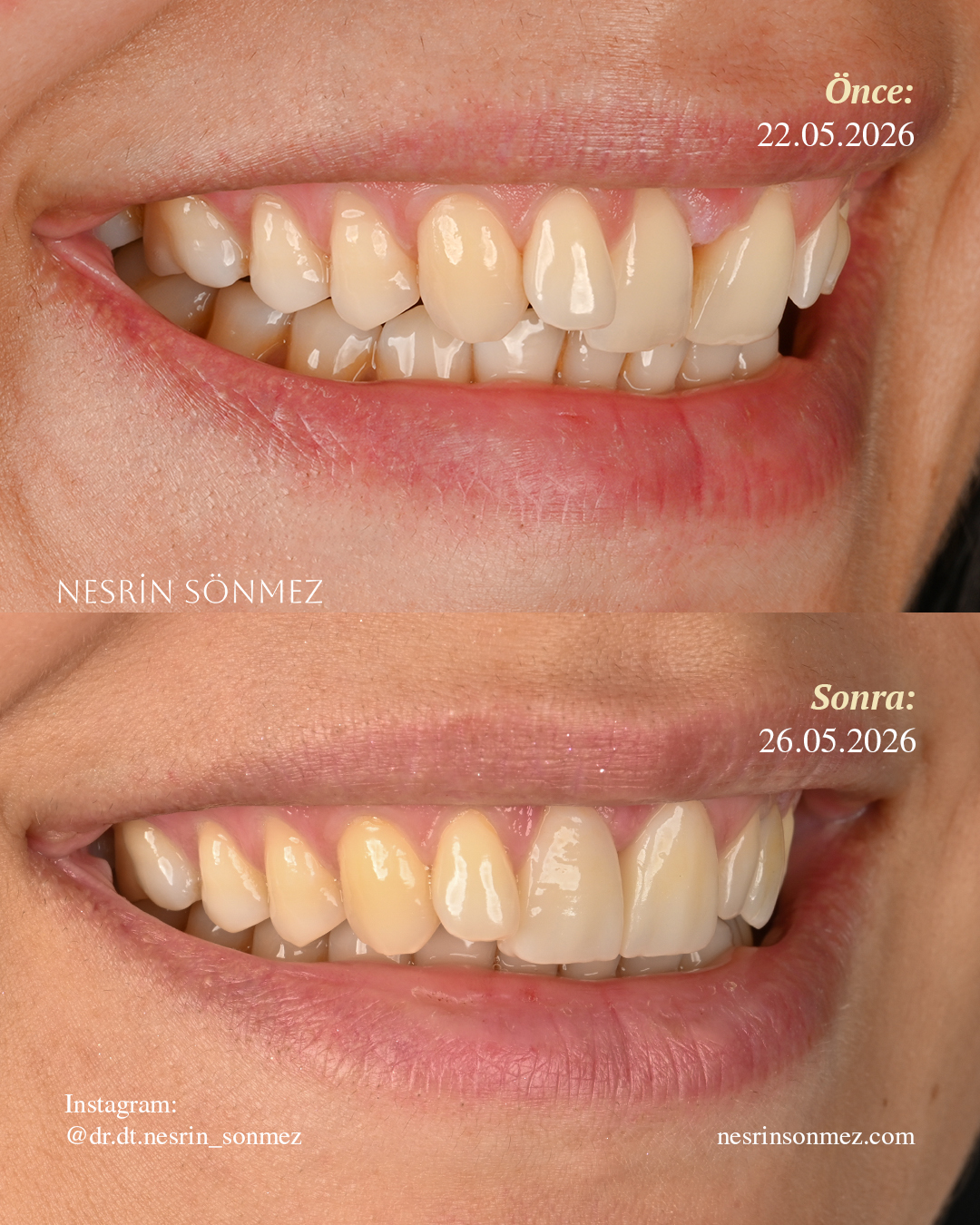 Case 9 before and after — view 2