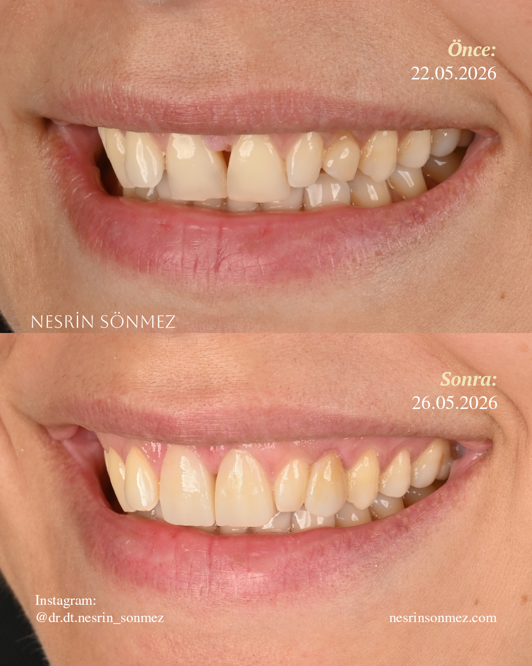 Case 9 before and after — view 3