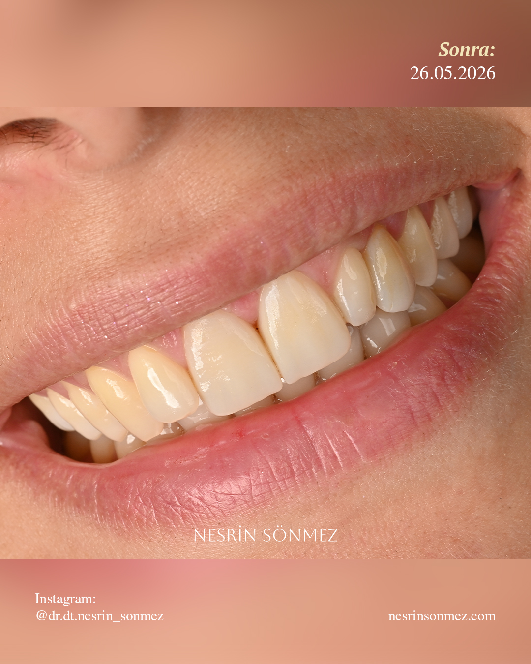Case 9 before and after — view 4