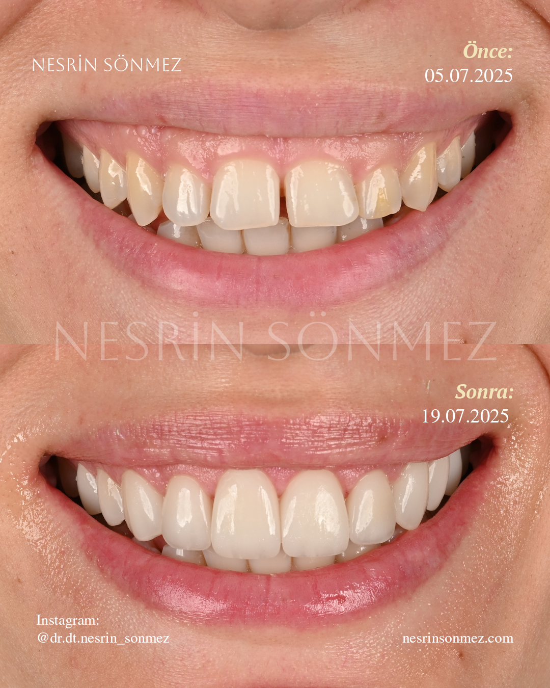 Case 10 before and after — view 1