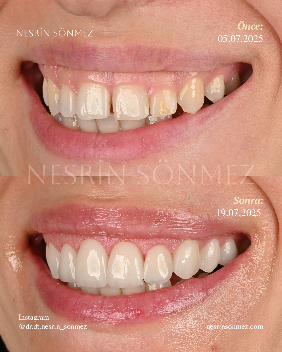 Case 10 before and after — view 2