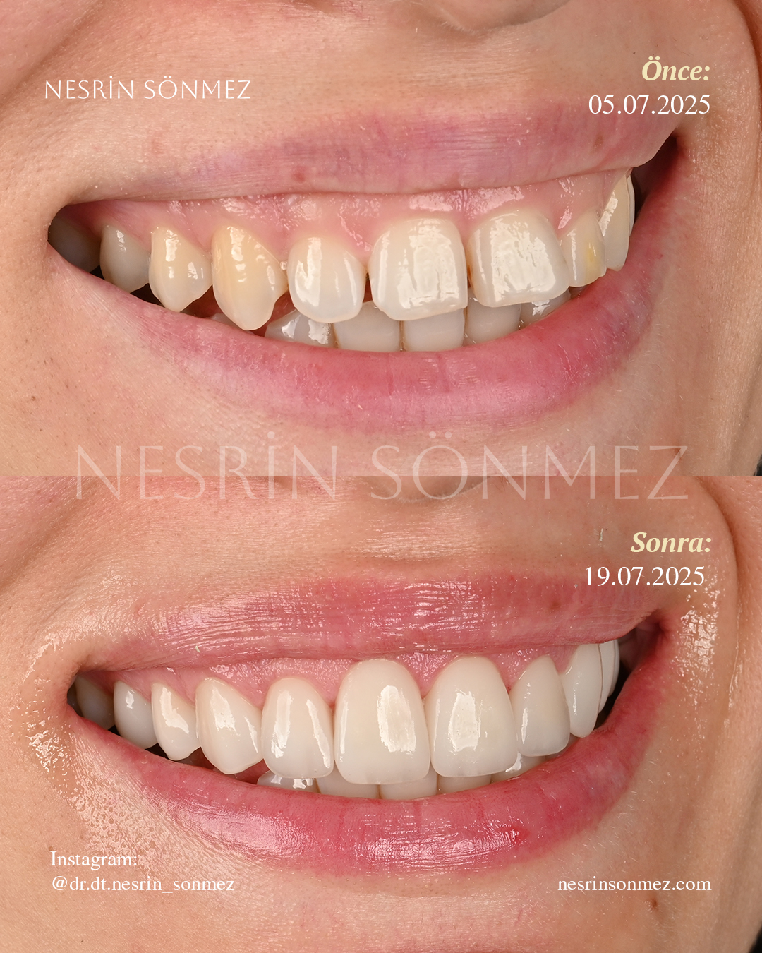 Case 10 before and after — view 3