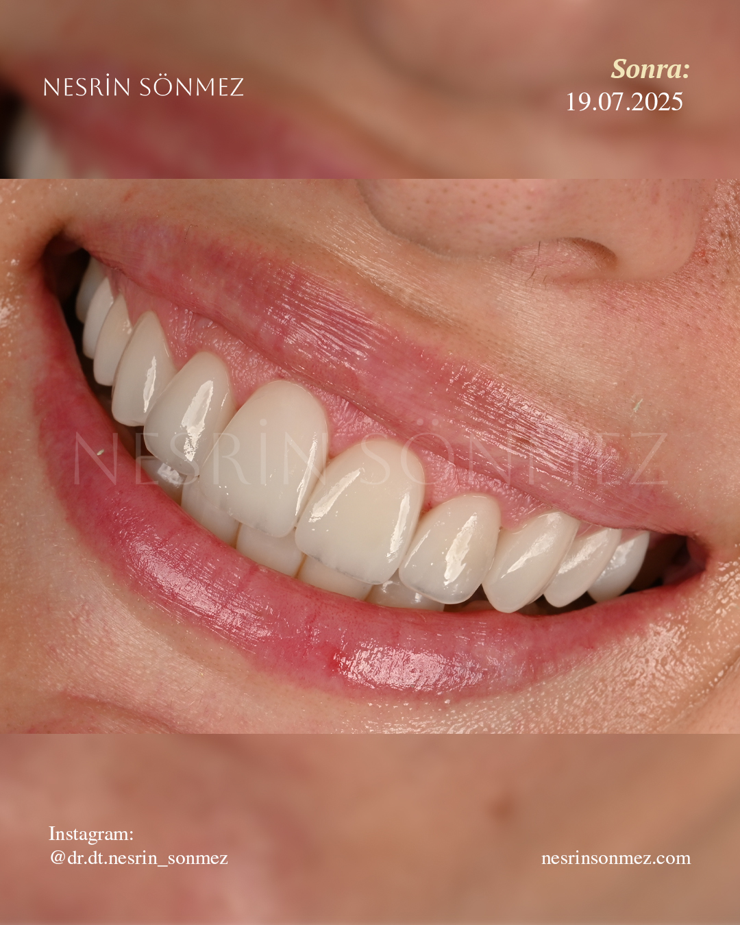 Case 10 before and after — view 4