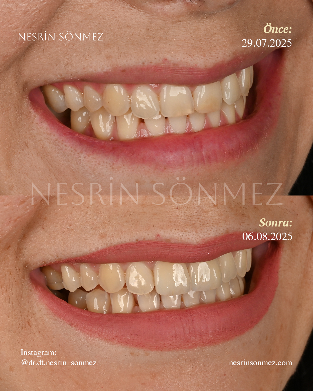 Case 11 before and after — view 3
