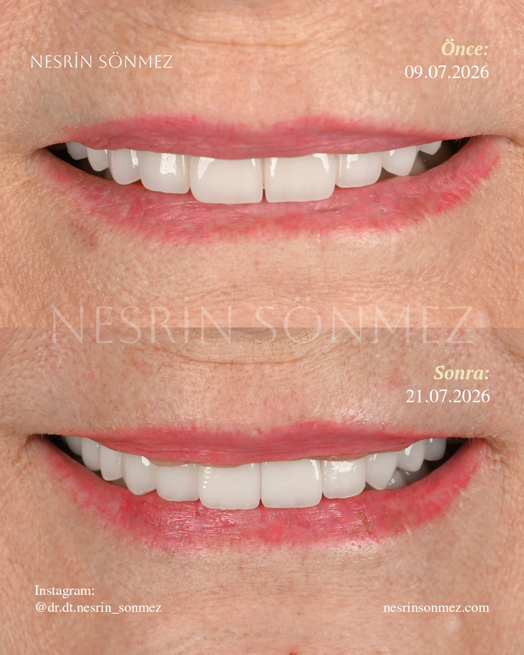 Case 12 before and after — view 2