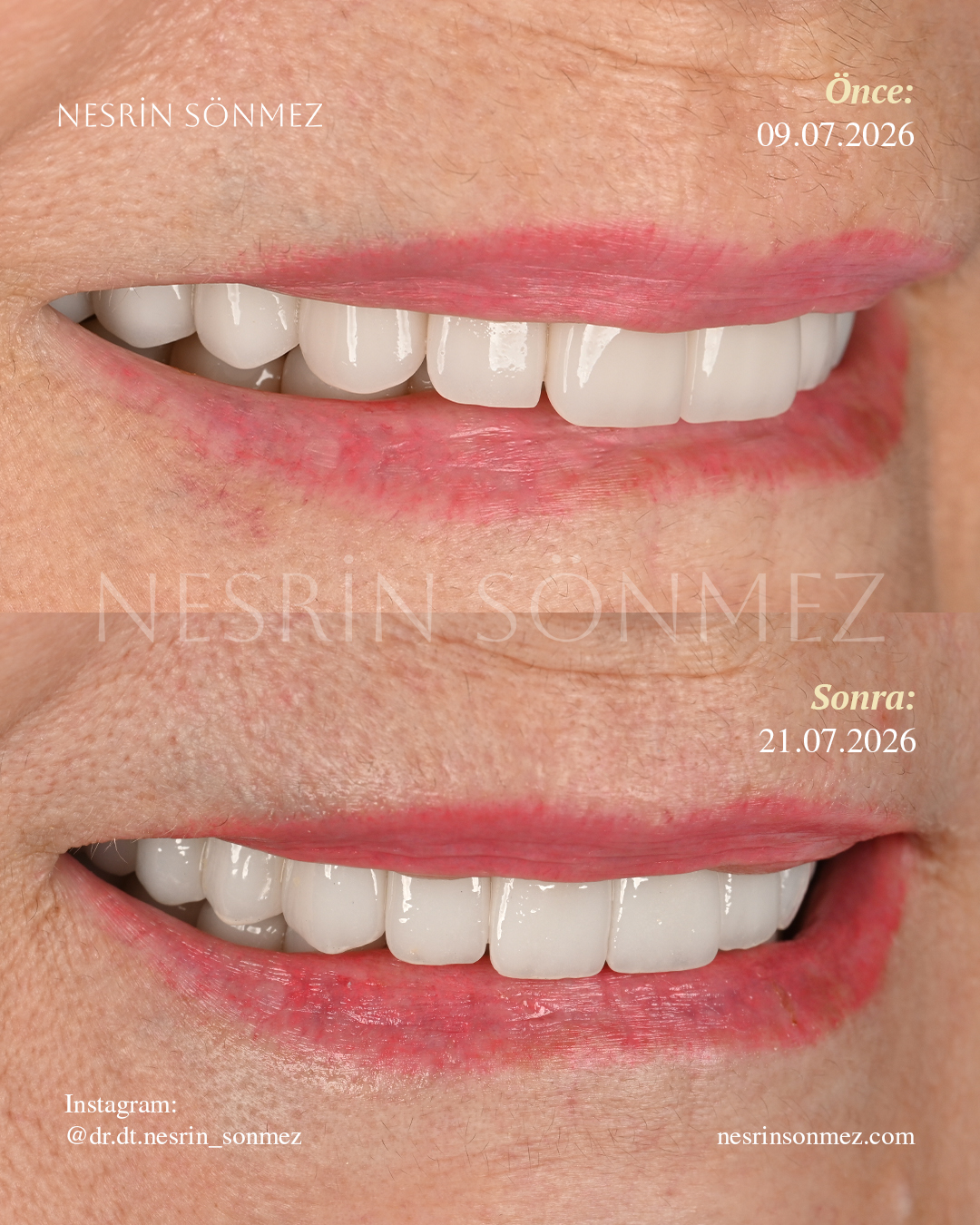 Case 12 before and after — view 3