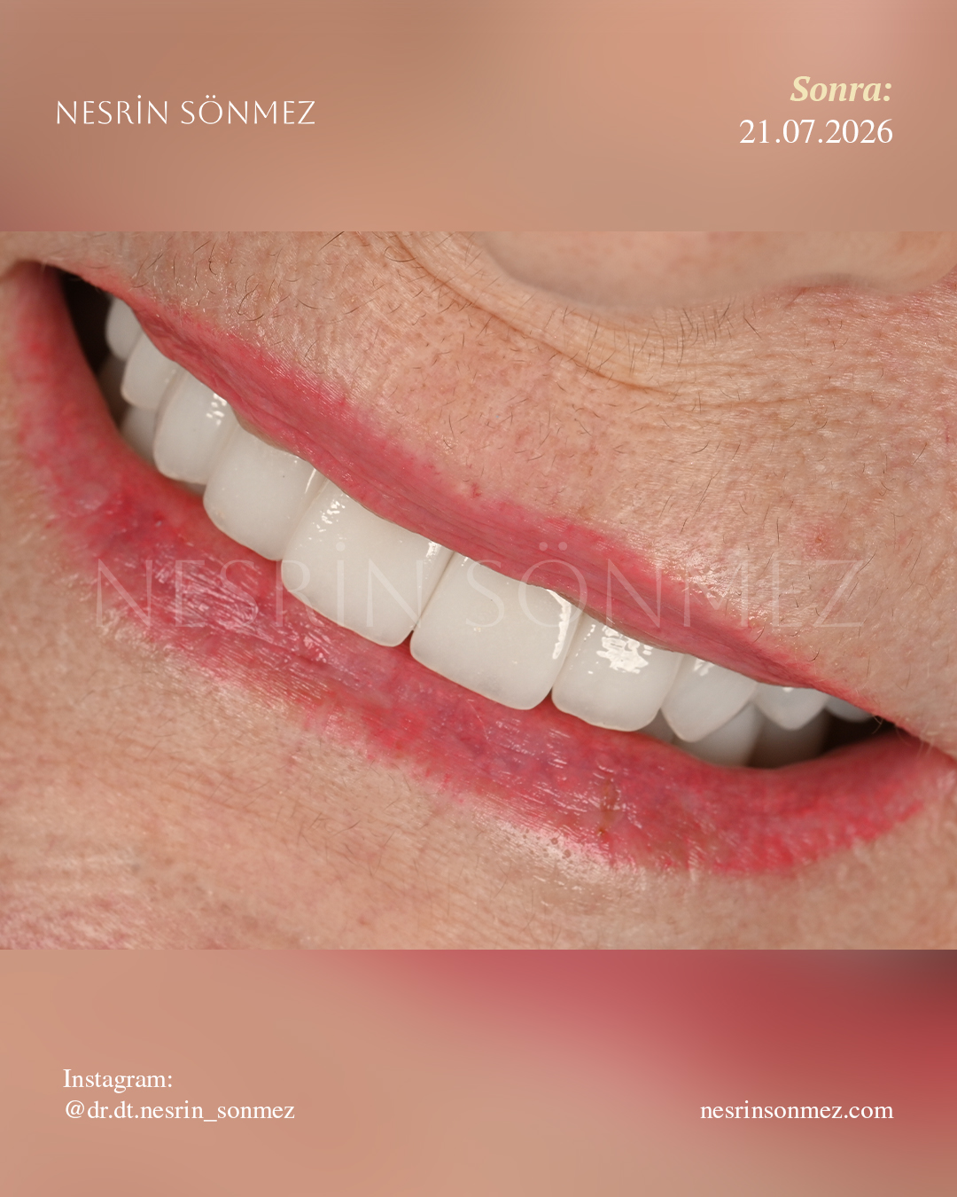 Case 12 before and after — view 4
