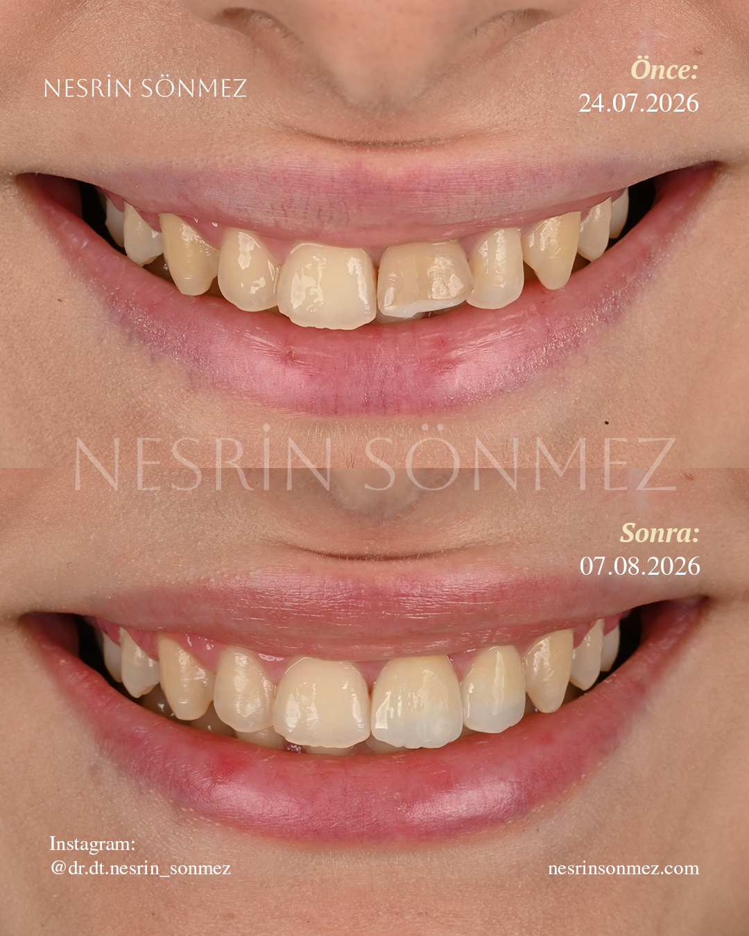 Case 13 before and after — view 1