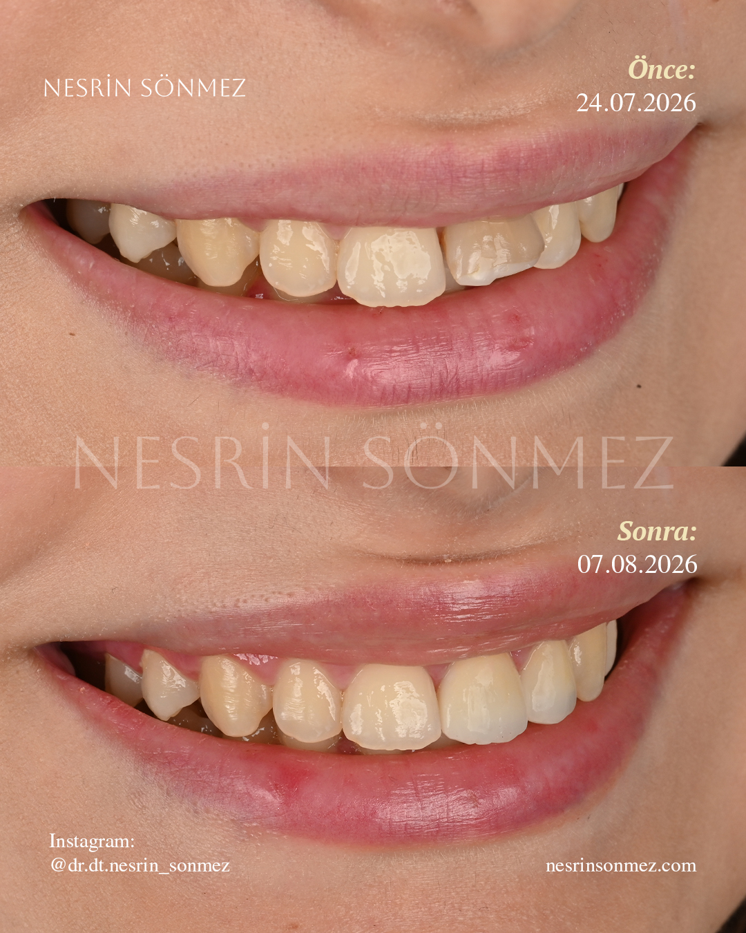 Case 13 before and after — view 2