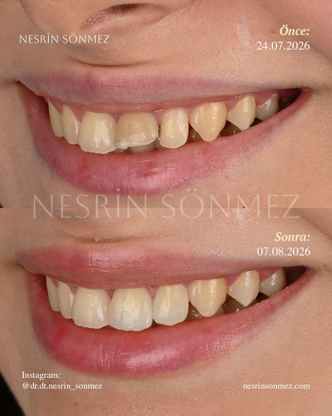 Case 13 before and after — view 3