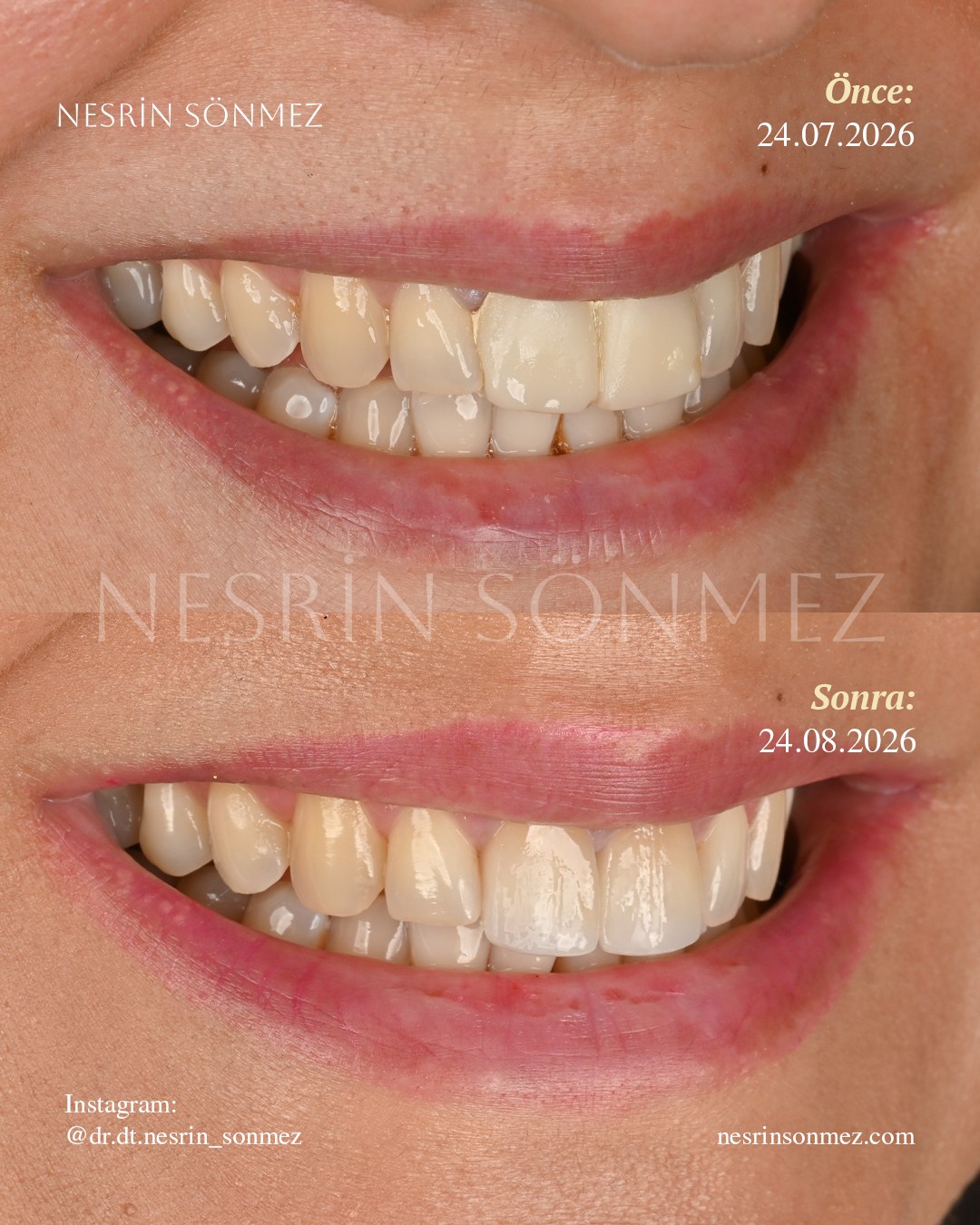 Case 14 before and after — view 2