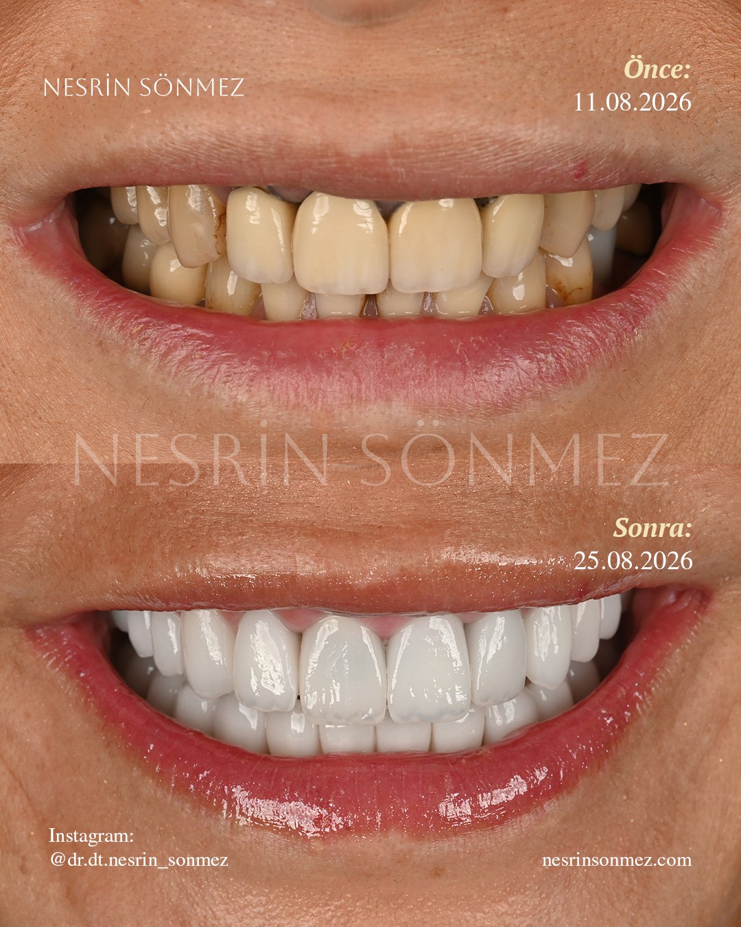 Case 15 before and after — view 1