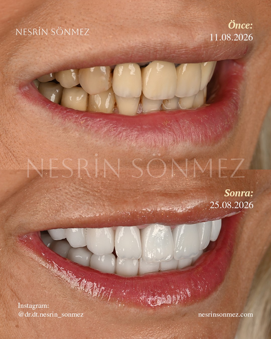 Case 15 before and after — view 2