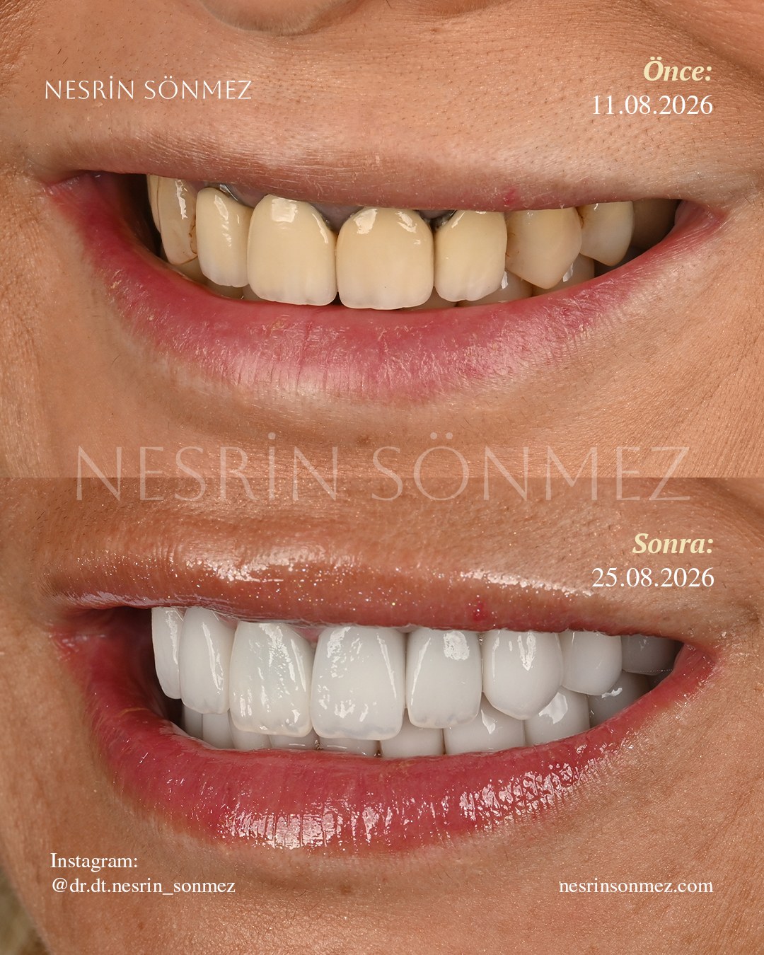Case 15 before and after — view 3
