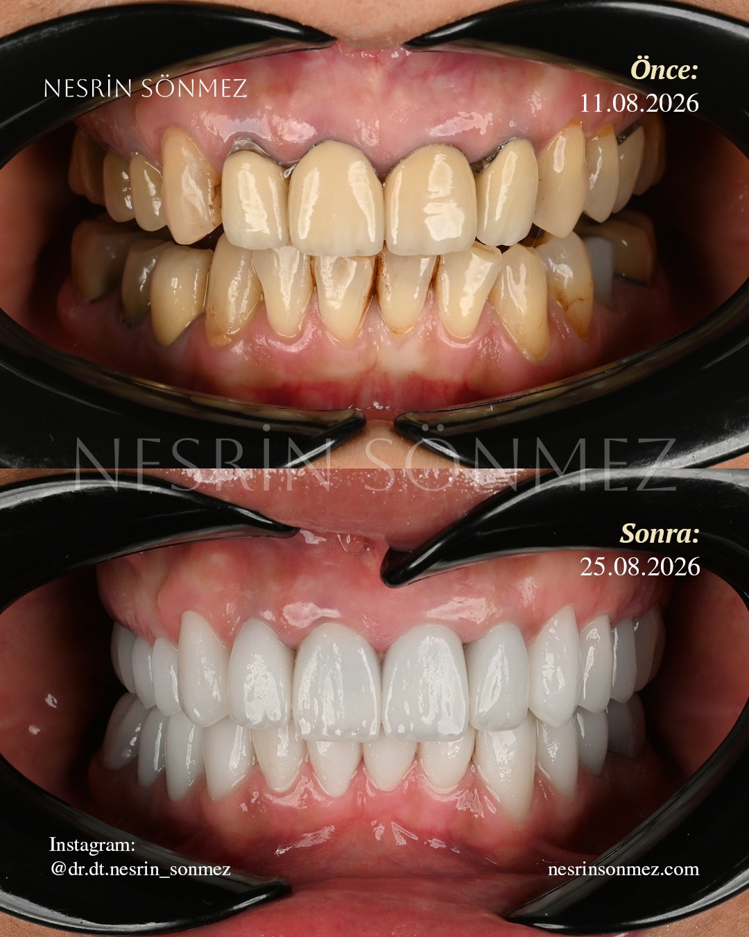 Case 15 before and after — view 4