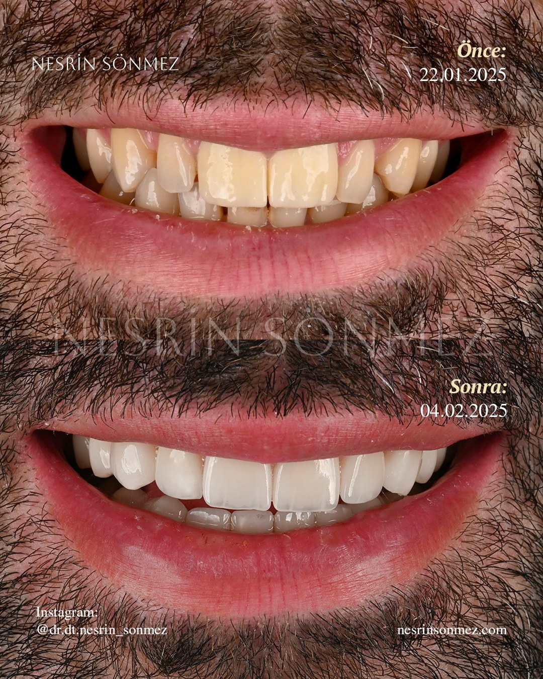 Case 16 before and after — view 1