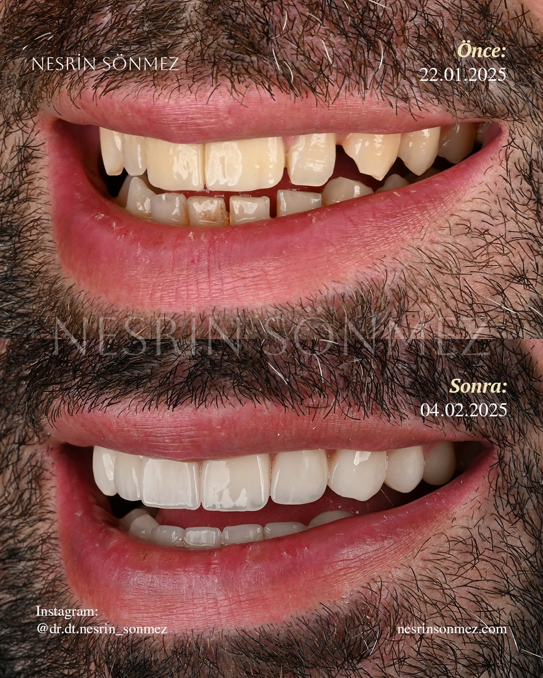 Case 16 before and after — view 2