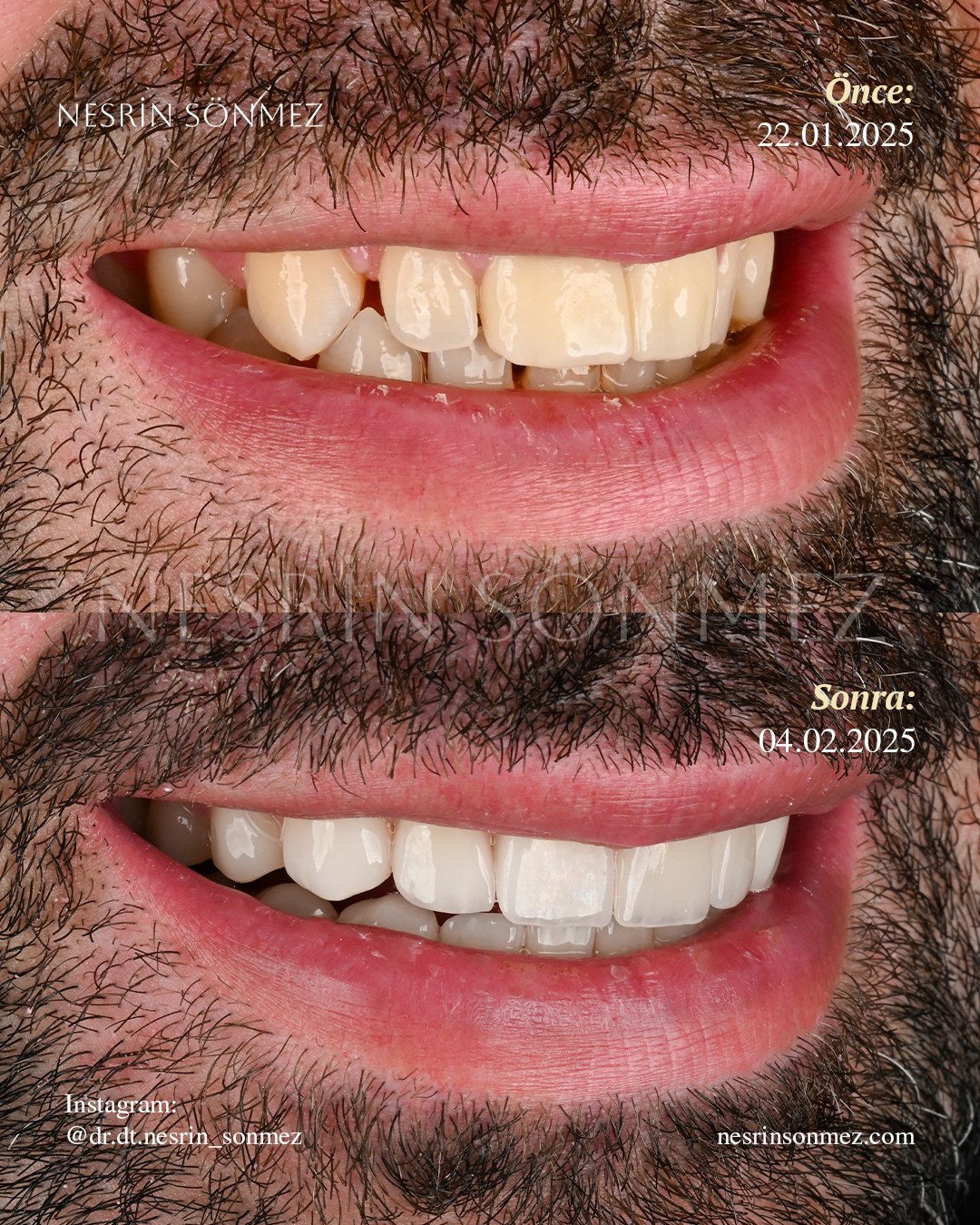 Case 16 before and after — view 3