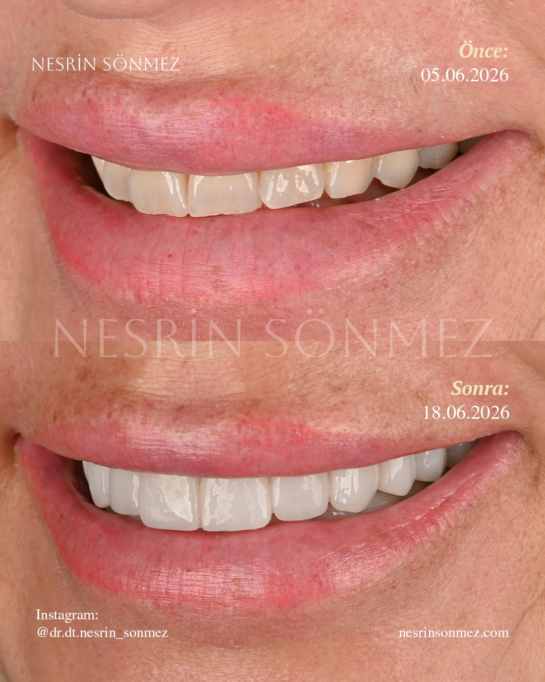 Case 17 before and after — view 2