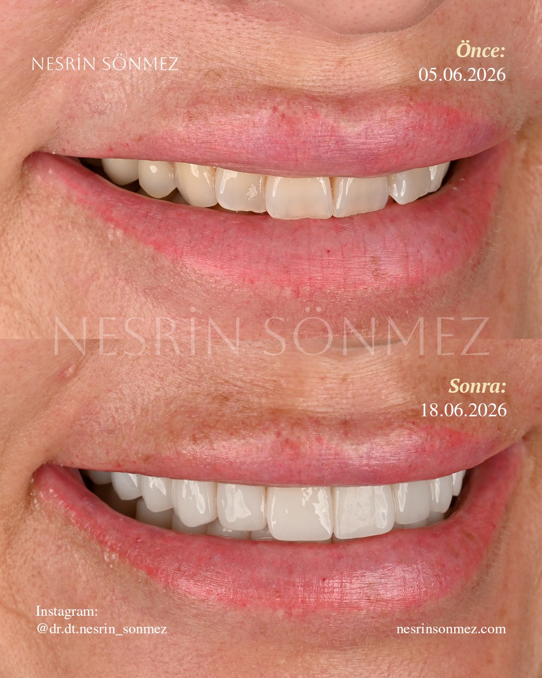 Case 17 before and after — view 3