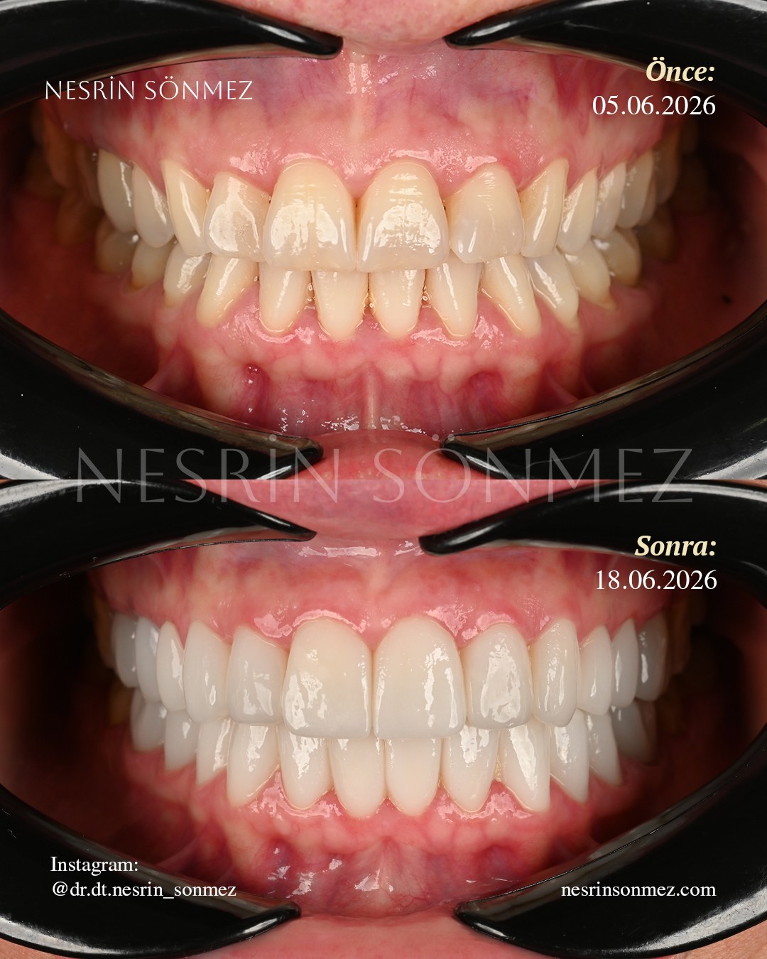 Case 17 before and after — view 4