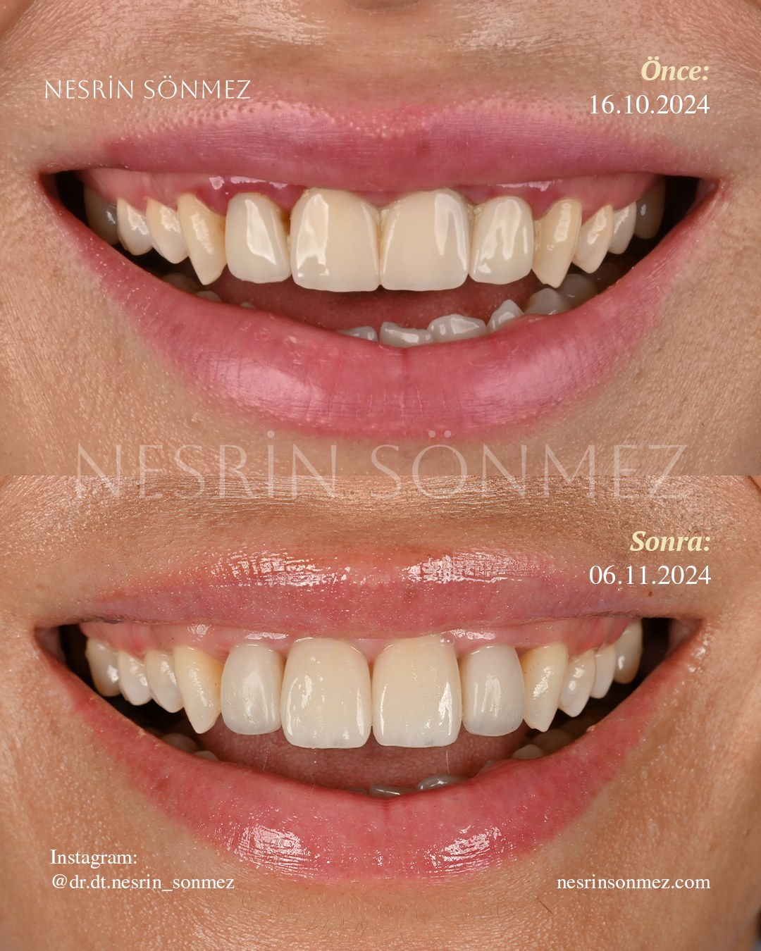 Case 18 before and after — view 1