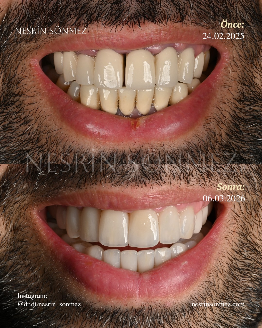Case 19 before and after — view 1