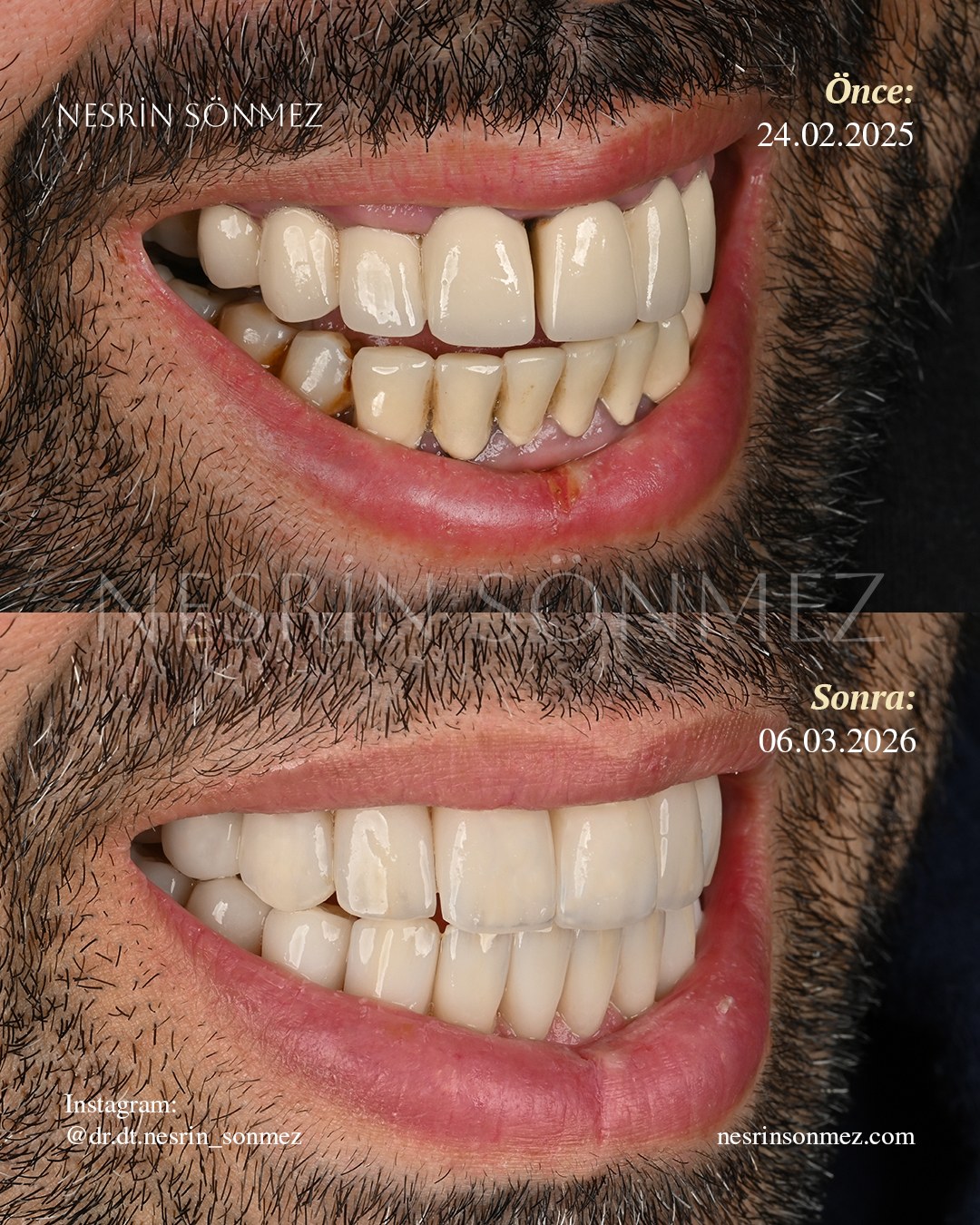 Case 19 before and after — view 2