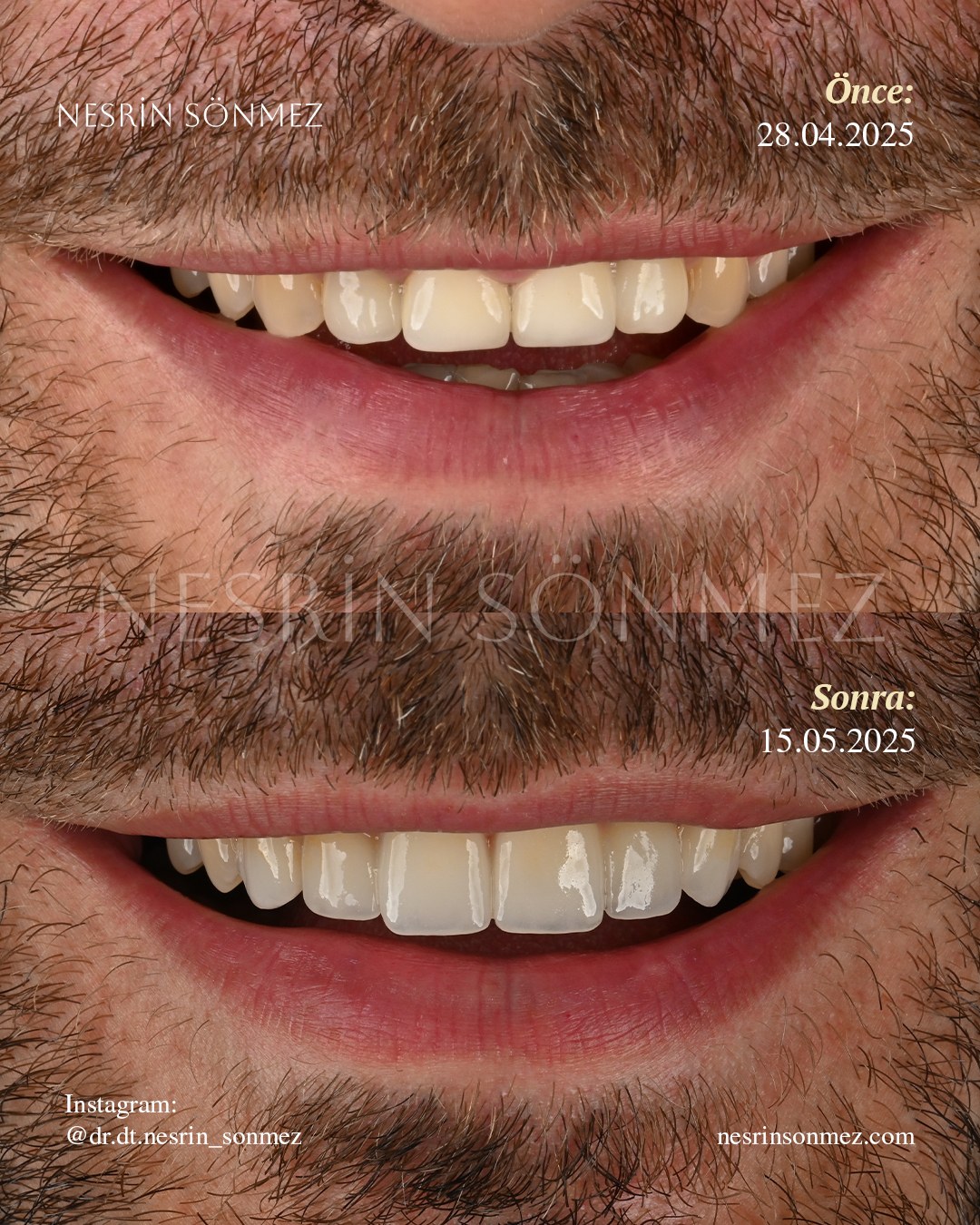 Case 20 before and after — view 1
