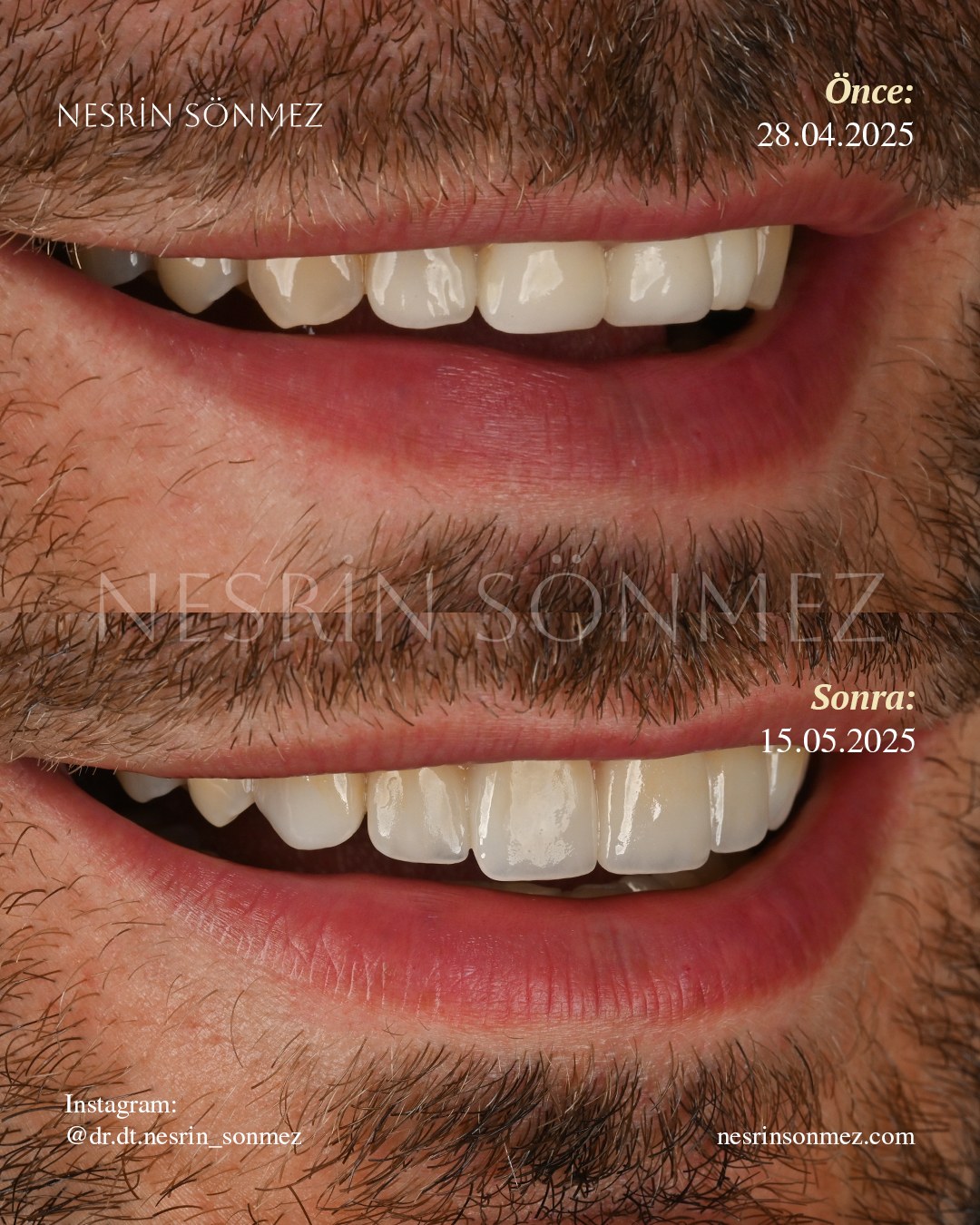 Case 20 before and after — view 2