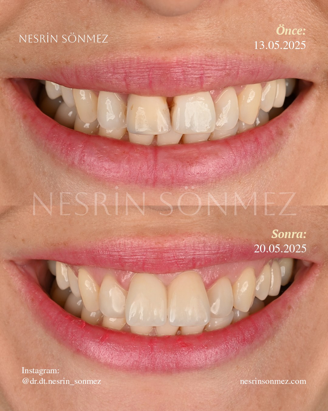 Case 21 before and after — view 1